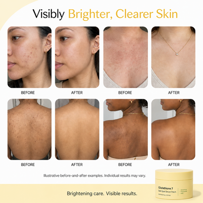 Glutathione 7 Dark Spot Serum Patch